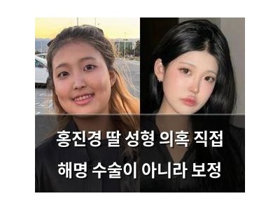 홍진경 딸 성형 의혹 직접 해명 수술이 아니라 보정