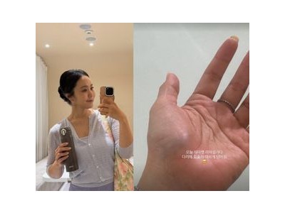 박지윤 리허설 중 넘어져 부상 알림